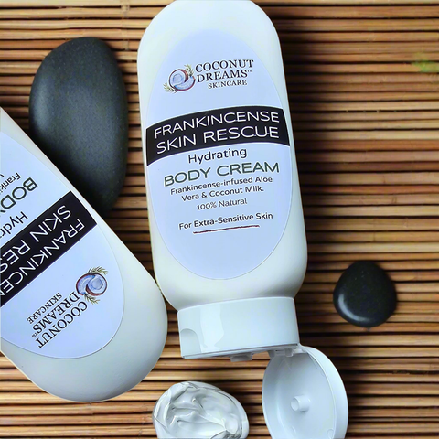 FRANKINCENSE SKIN RESCUE BODY CREAM | Sensitive Skin | 6.5 oz